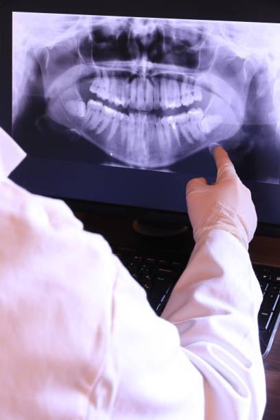 Best Emergency Wisdom Tooth Extraction in Putney, GA