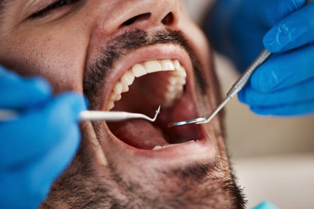 Best Urgent Dental Care for Toothaches in Putney, GA