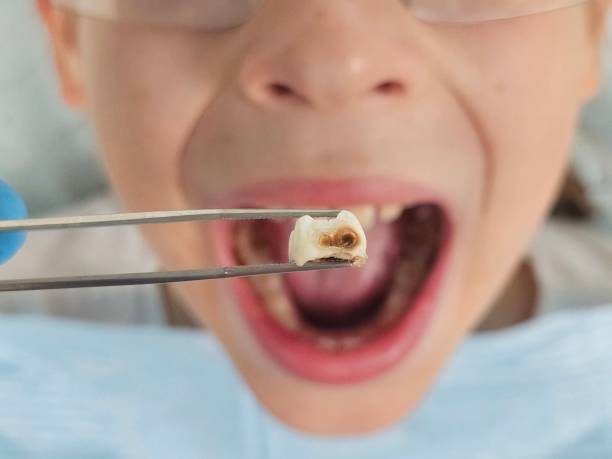 Best Walk-In Emergency Dental Services in Putney, GA